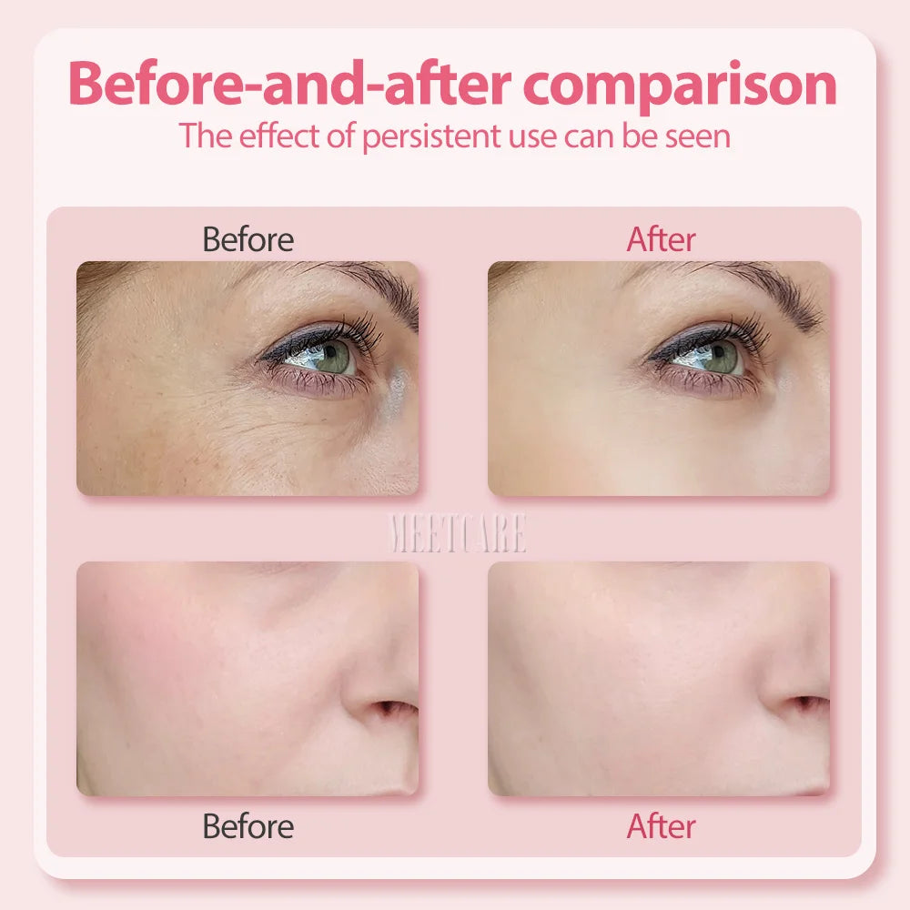 4in1 Eye Facial Massage Wand