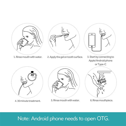 Teeth Whitening Smart LED Blue Light