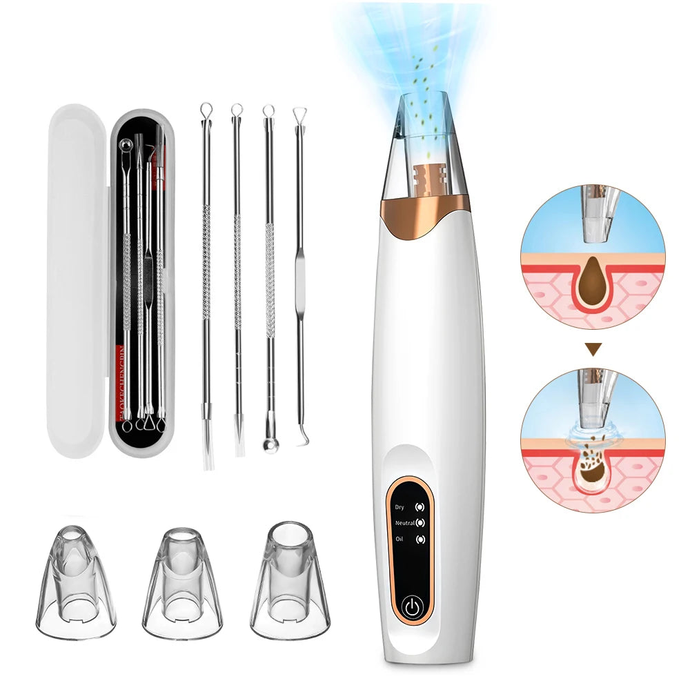 3 Suction Mode Blackhead Remover