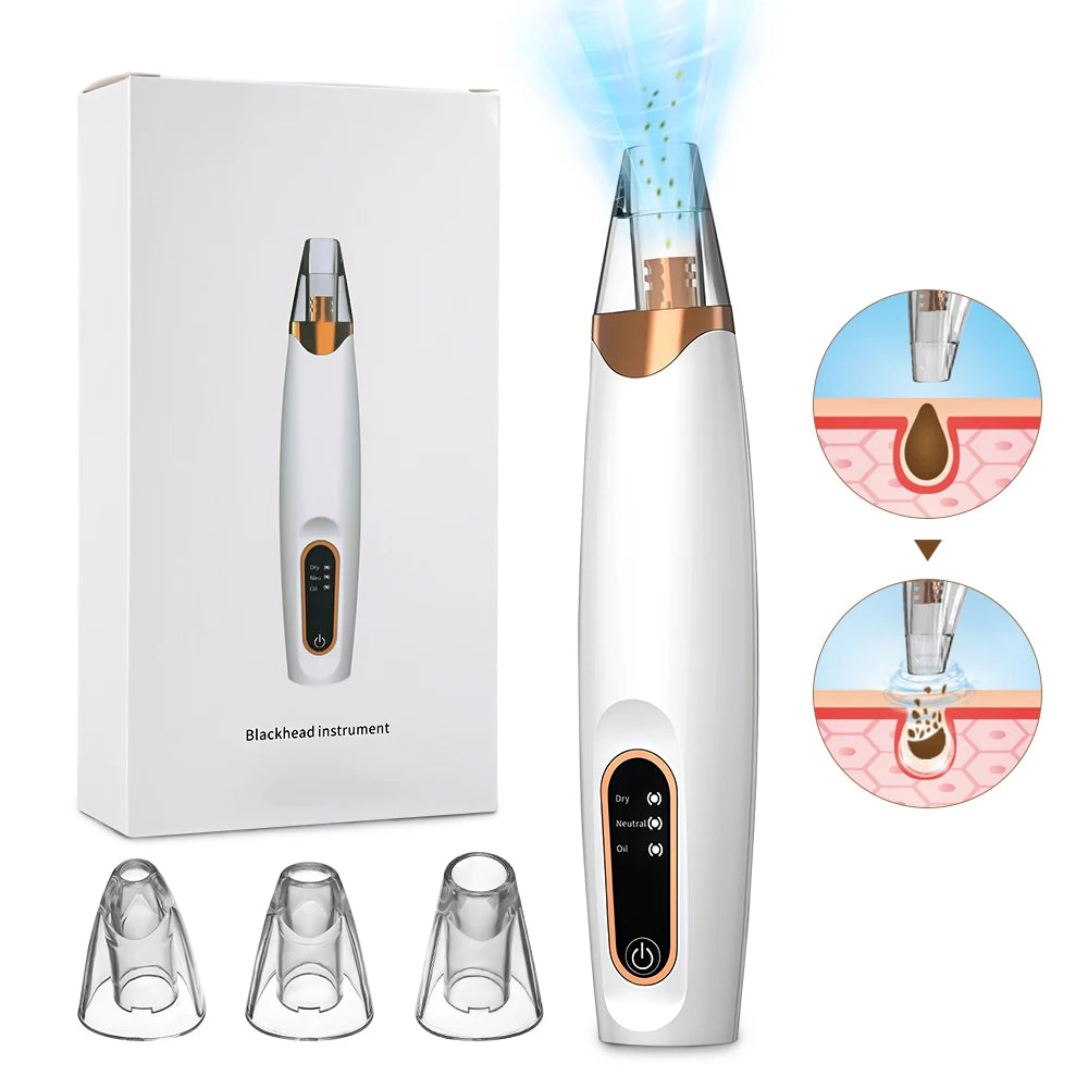 3 Suction Mode Blackhead Remover